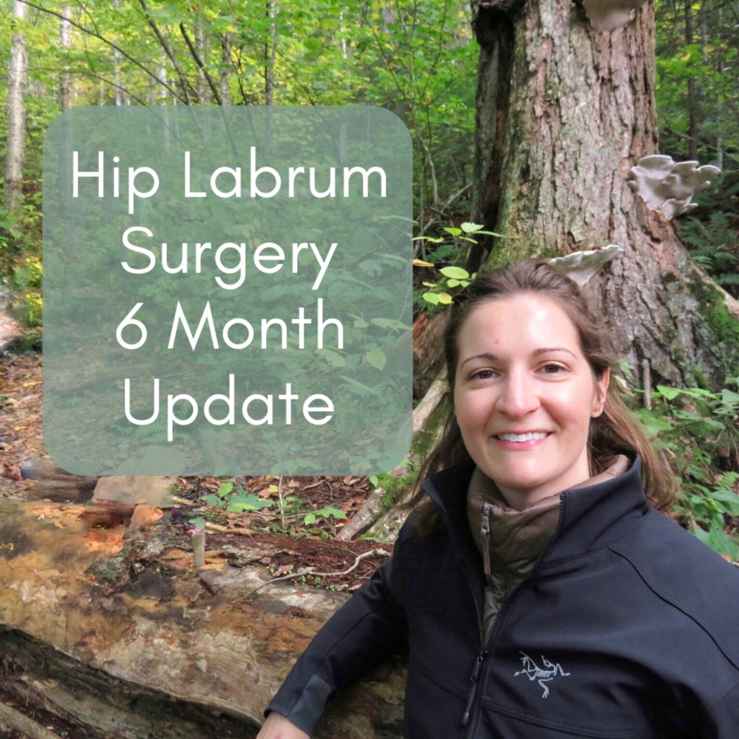 6 Month Update After Hip Labral Tear Surgery